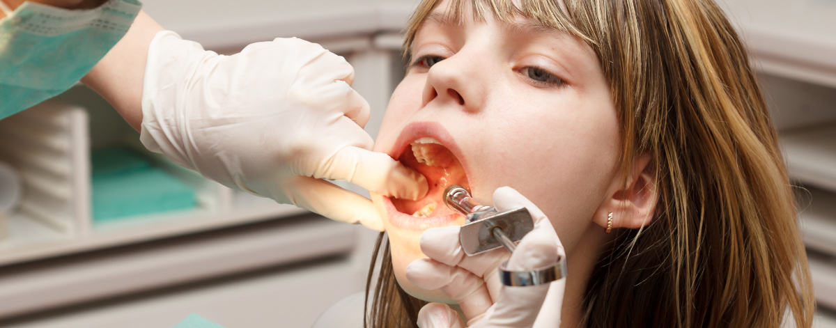 Stomatologia dziecięca